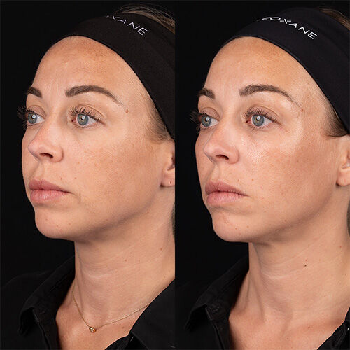 Before & Afters